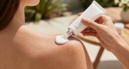 15 Best Sunburn Relief Lotions in 2026